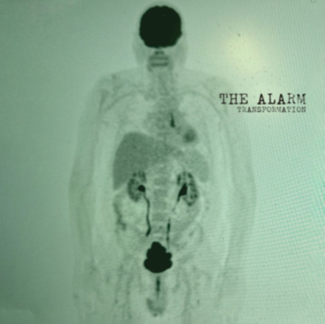 The Alarm: Transformation - CD