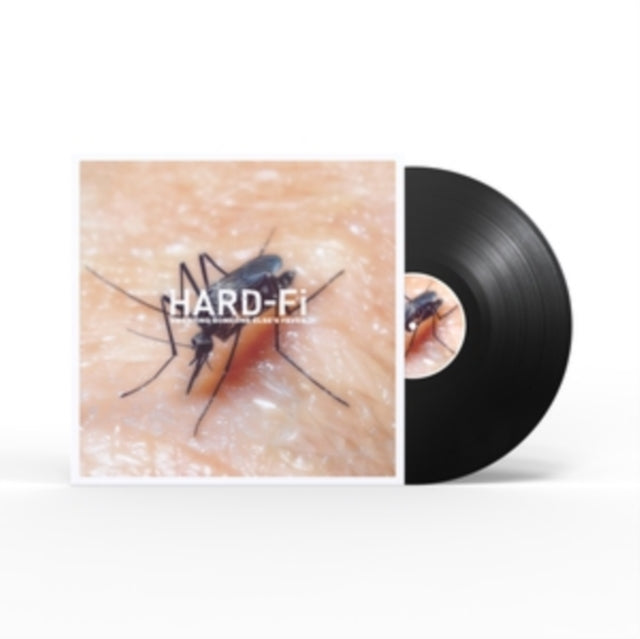 Hard-Fi: Sweating Someone Elses Fever - Vinyl
